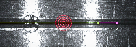 Laserschweißen mit Sichtprüfung | MedTech Case Study by HAHN Automation Group